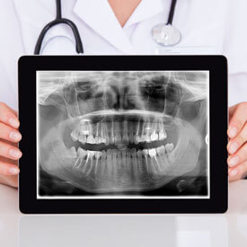 Digital X-rays Image